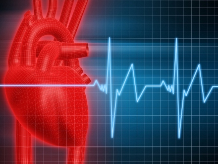Regelmäßige Überstunden erhöhen Herzinfarktrisiko
