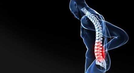 Volkskrankheit Rückenschmerzen